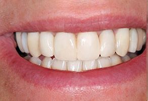 Elizabeth Smiline NJ, LLC | Oral Exams, Invisalign and Root Canals