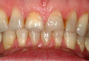 Elizabeth Smiline NJ, LLC | Periodontal Treatment, Emergency Treatment and Root Canals