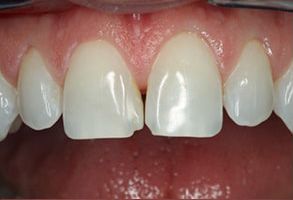 Elizabeth Smiline NJ, LLC | Teeth Whitening, Dental Fillings and Oral Exams